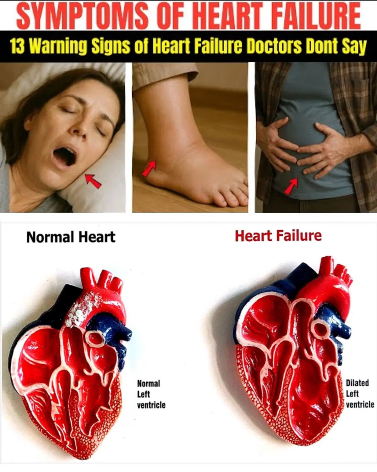 13 Early Signs of Heart Failure (You Ignore Daily) | Symptoms of Heart Failure