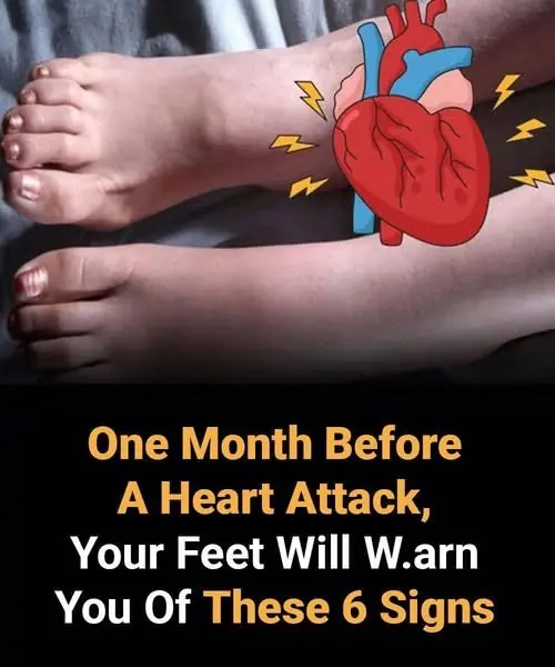 6 Foot Symptoms That May Warn of a Heart Attack Weeks in Advance