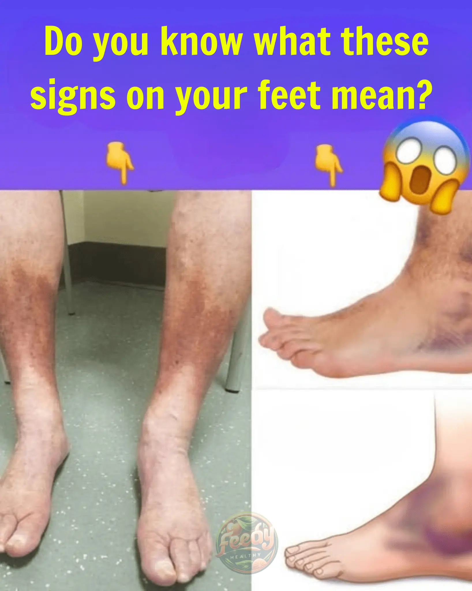 Do You Know What These Signs on Your Feet Mean?