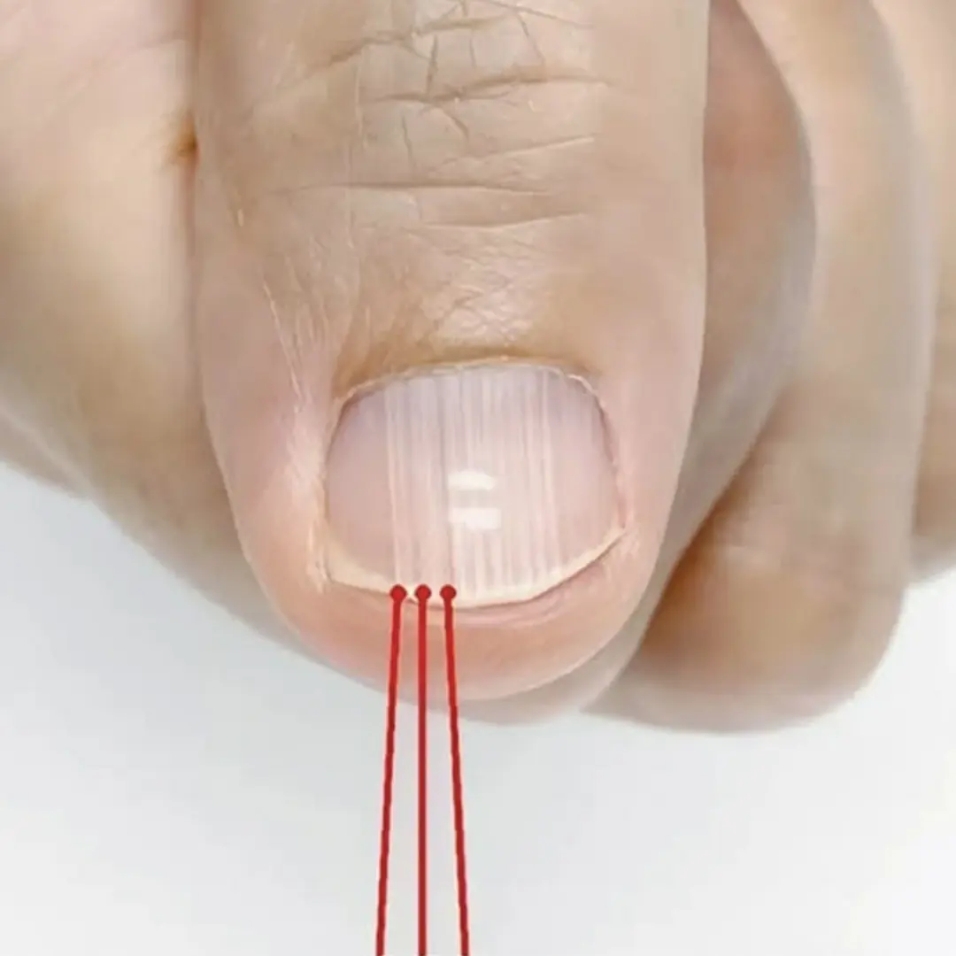 🔍 What Those Vertical Lines on Your Nails Really Reveal