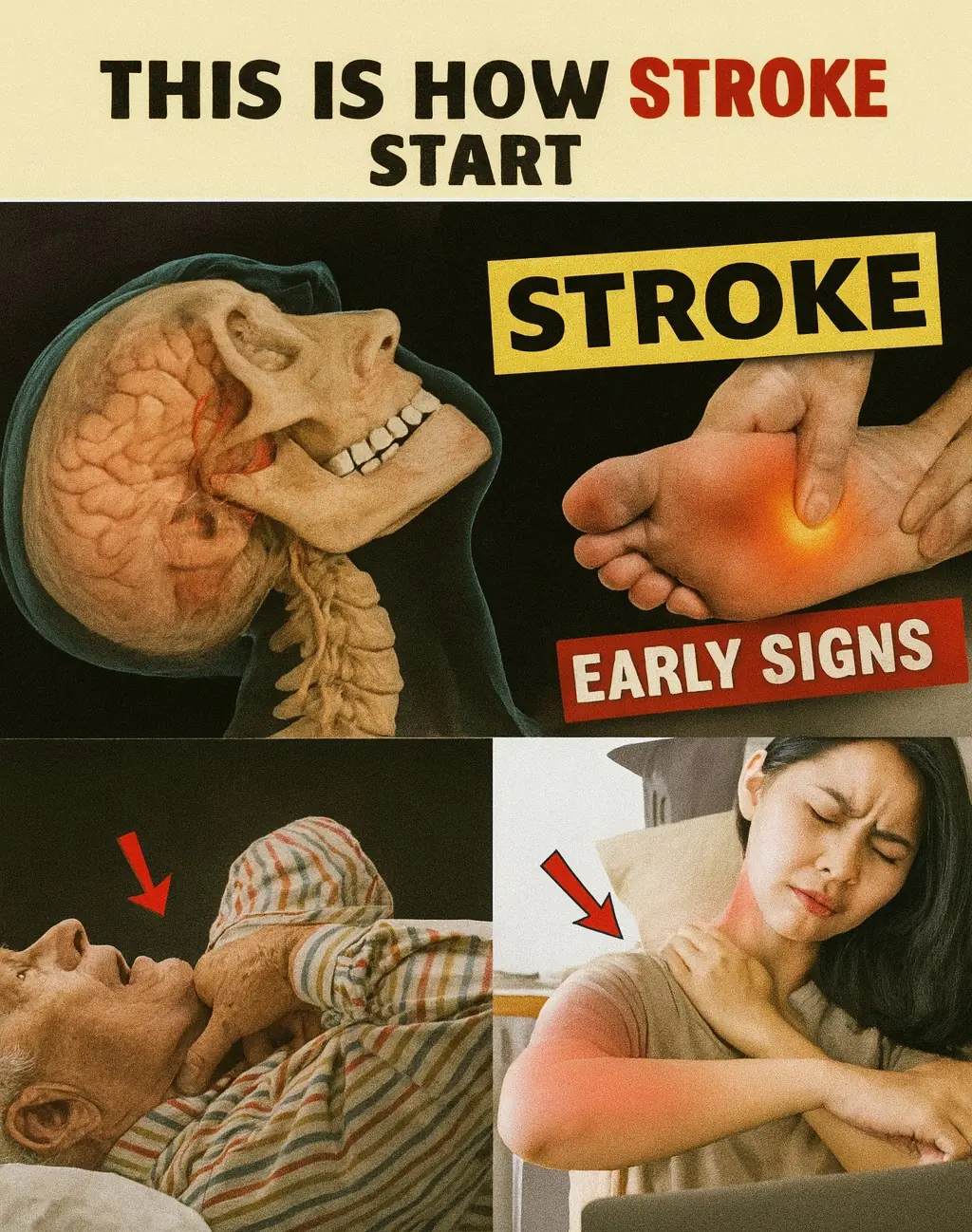 Could Your Body Be Warning You of a Stroke? 8 Subtle Signs to Watch For and 9 Proven Ways to Protect Yourself