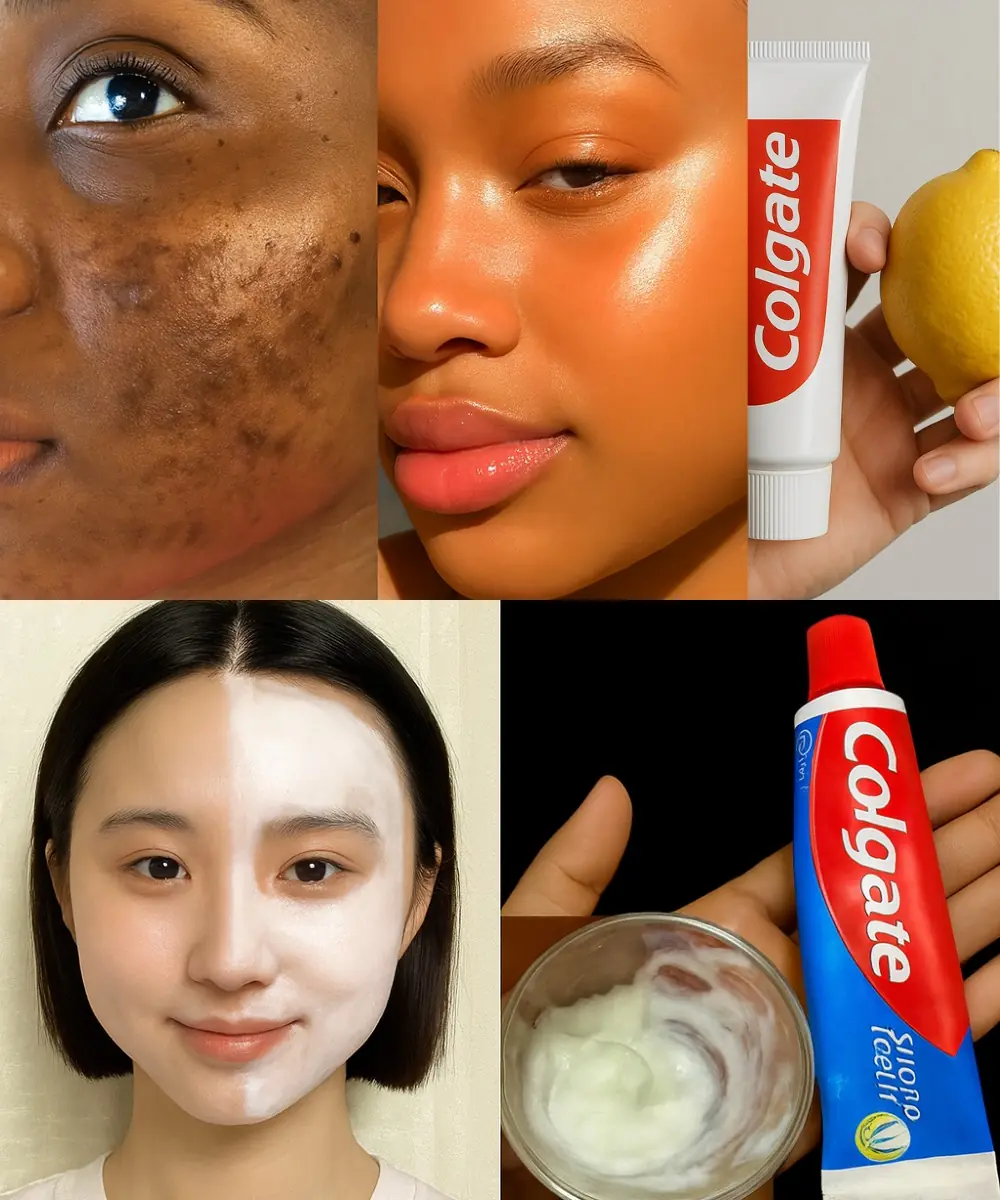The Surprising Truth About Using Lemon and Colgate for a Radiant Face