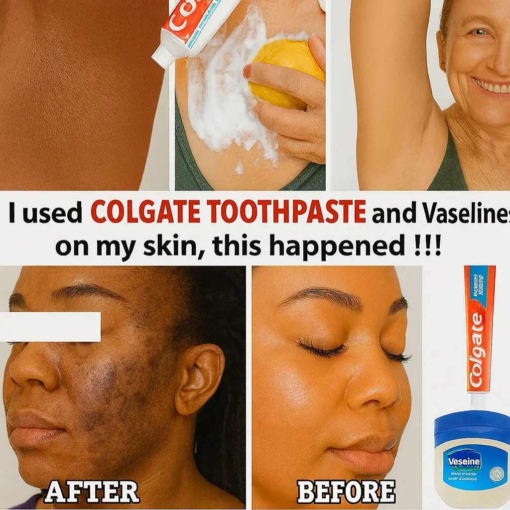 Unlock Radiant Skin: The Colgate and Lemon Glow Secret You NEED to Know!