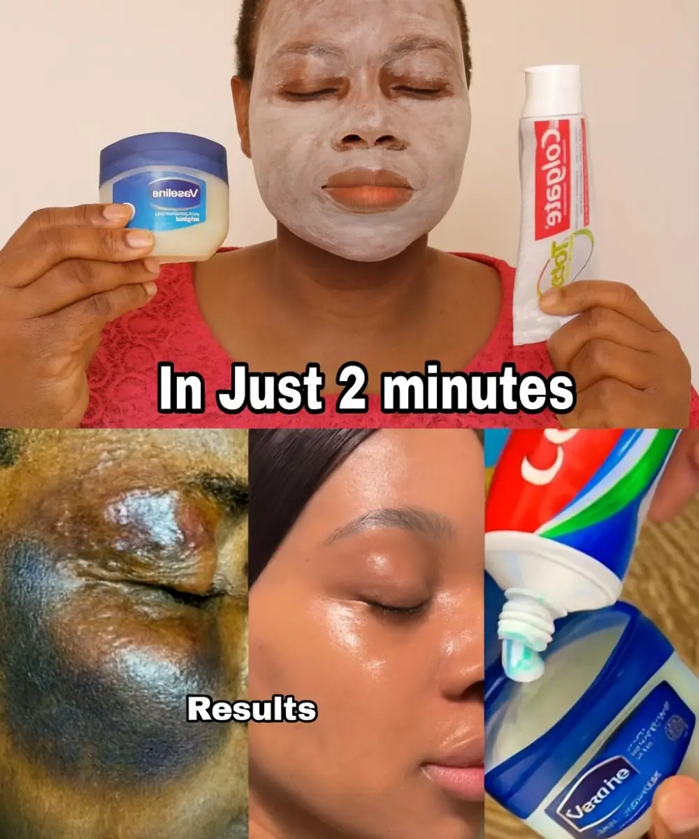Uncover the Viral Toothpaste & Vaseline Skincare Secret That’s Taking Over 2025!