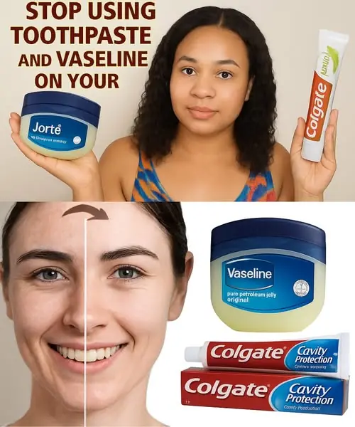 Toothpaste and Vaseline: A Risk for Your Skin?