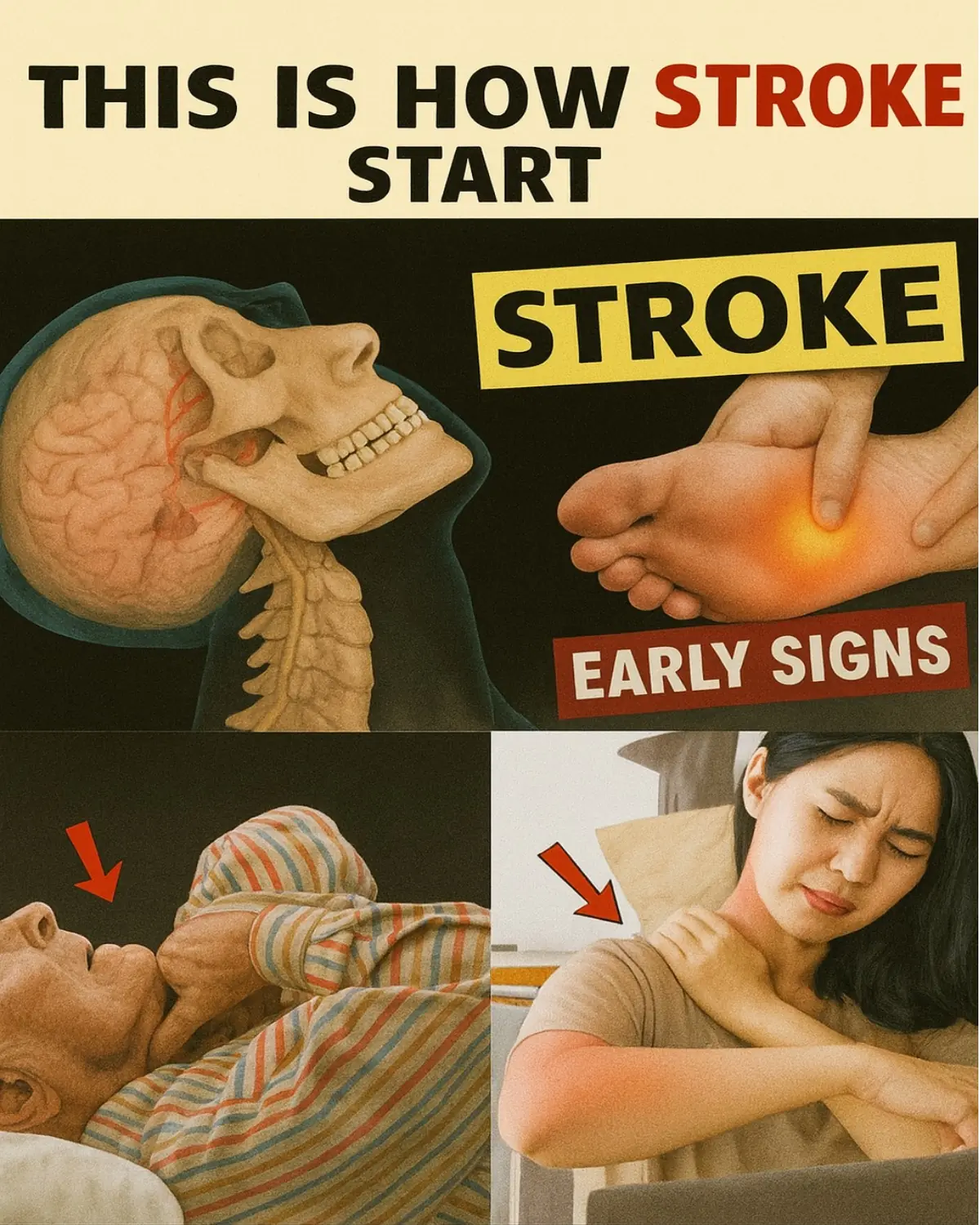 8 Subtle Signs Your Body May Warn You of a Stroke