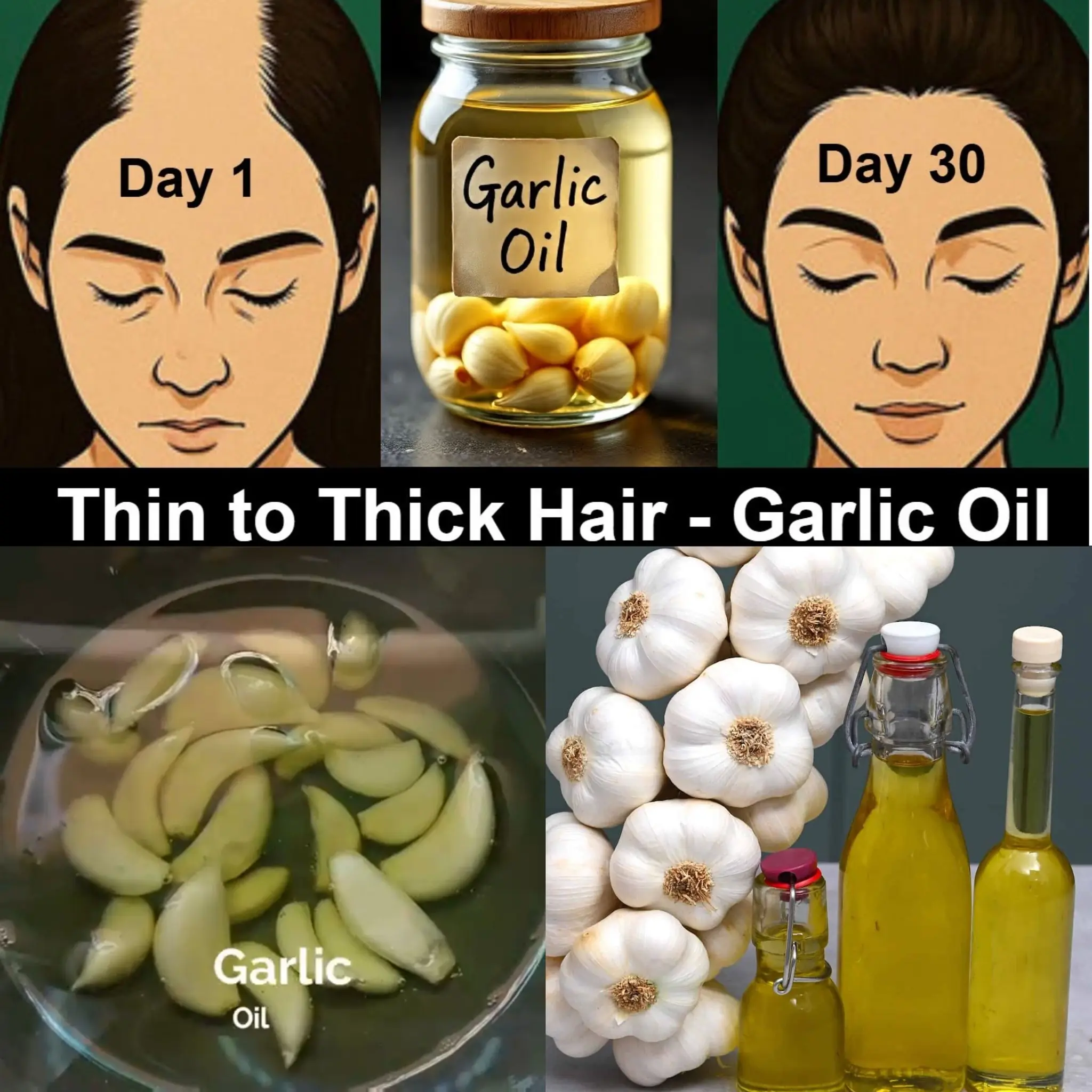 Garlic Oil for Hair Growth – Thin to Thick Hair | Long Hair | Increase Hair Density & Hair Volume
