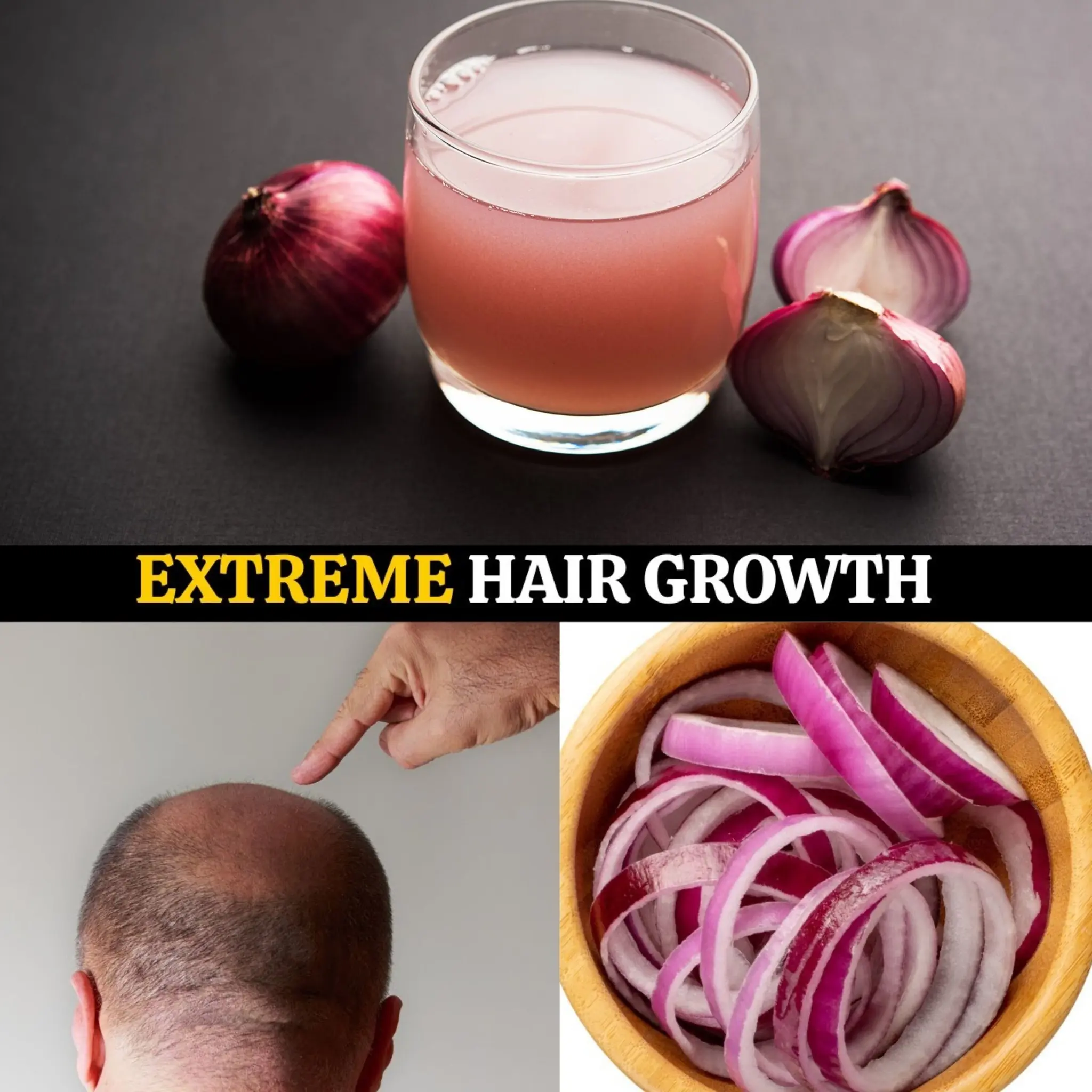Onion Juice for Hair Growth: The Shocking Secret to Stop Hair Loss Fast!
