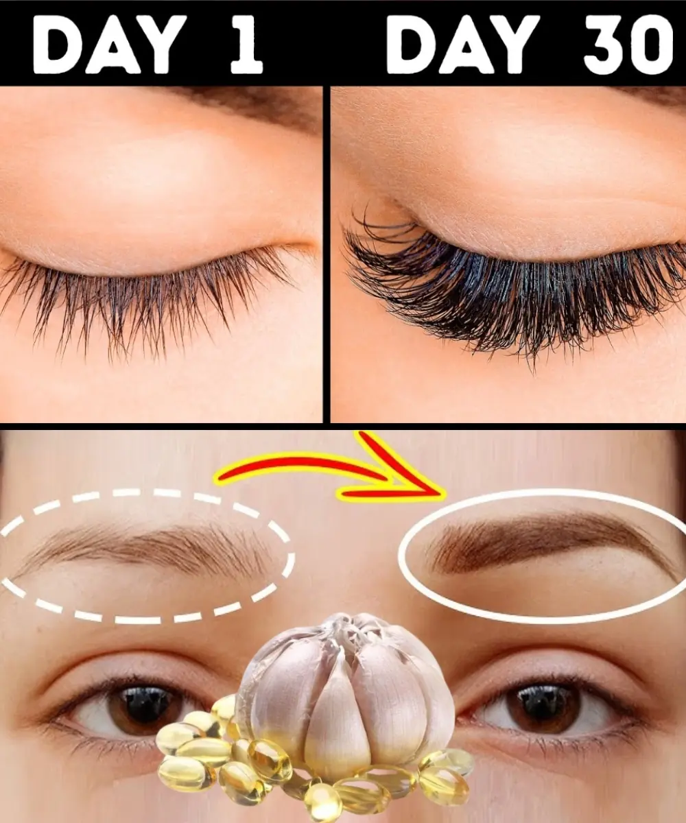 How to Grow Thicker Eyebrows and Longer Eyelashes Naturally with Garlic and Vitamin E