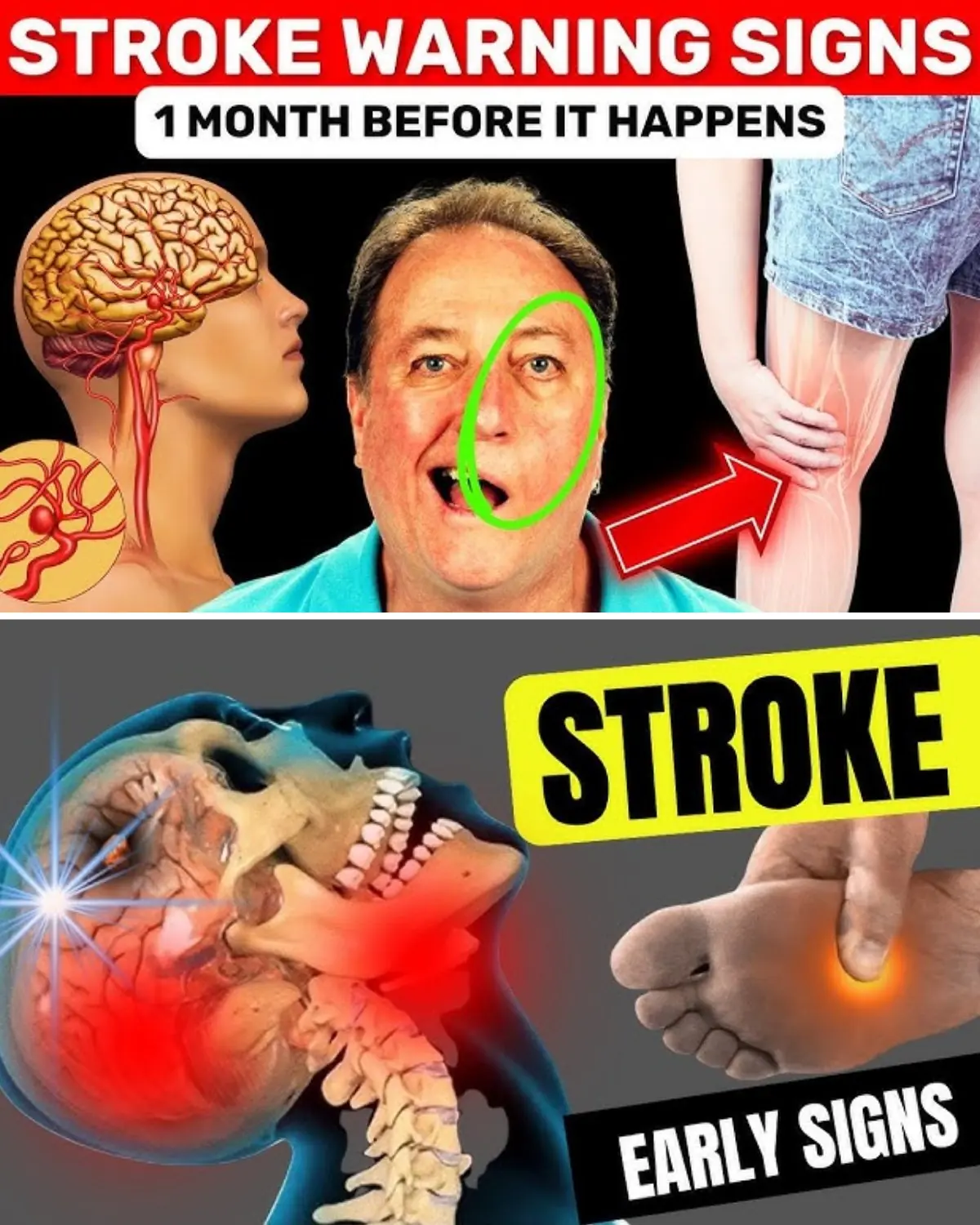8 Stroke Warning Signs and 9 Tips to Prevent It