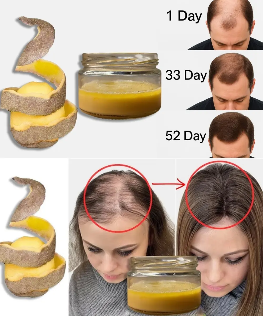 I Couldn’t Believe It! My Bald Spot Grew Hair Like Crazy With Just One Potato