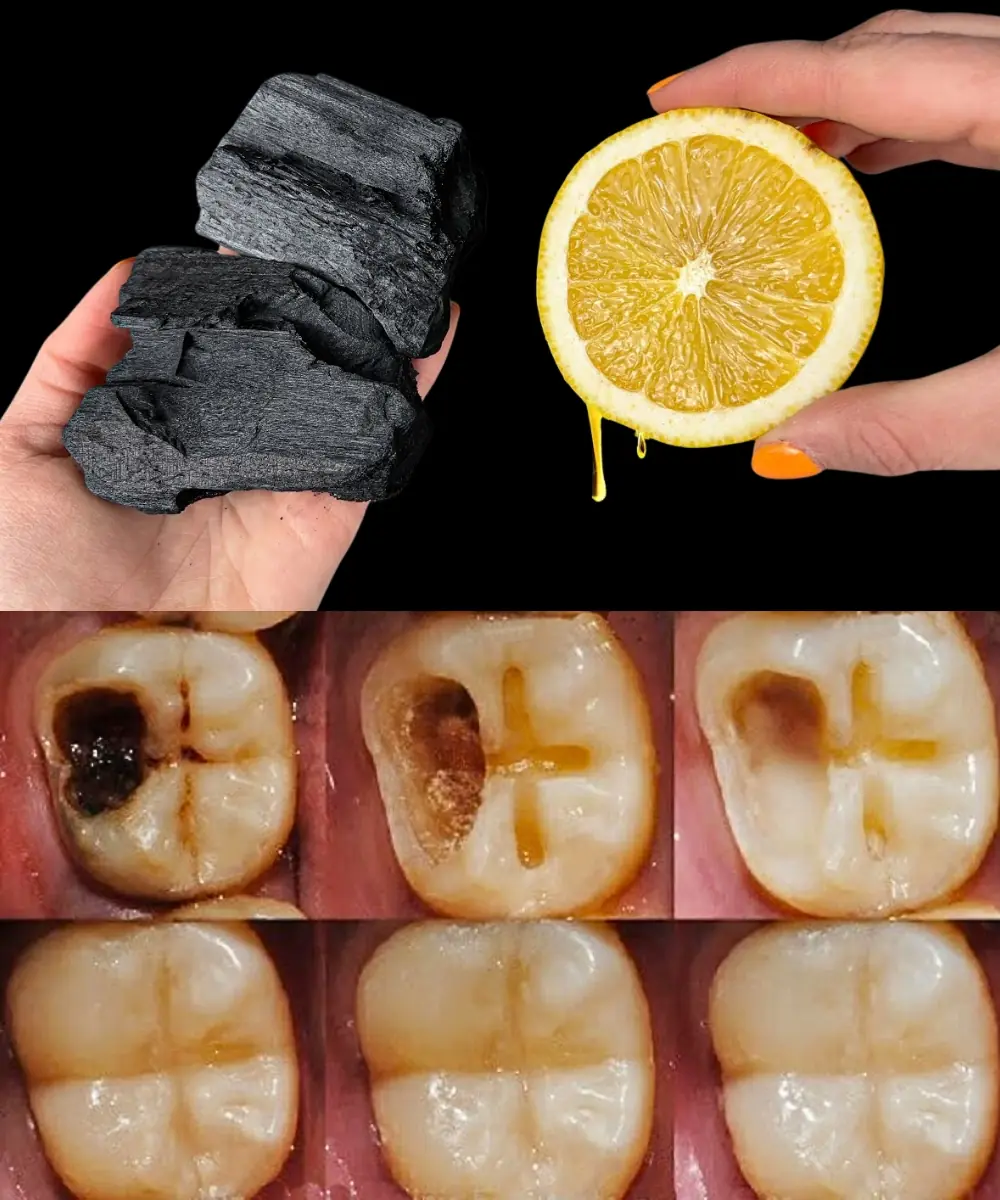 Natural Ways to Protect and Repair Your Teeth