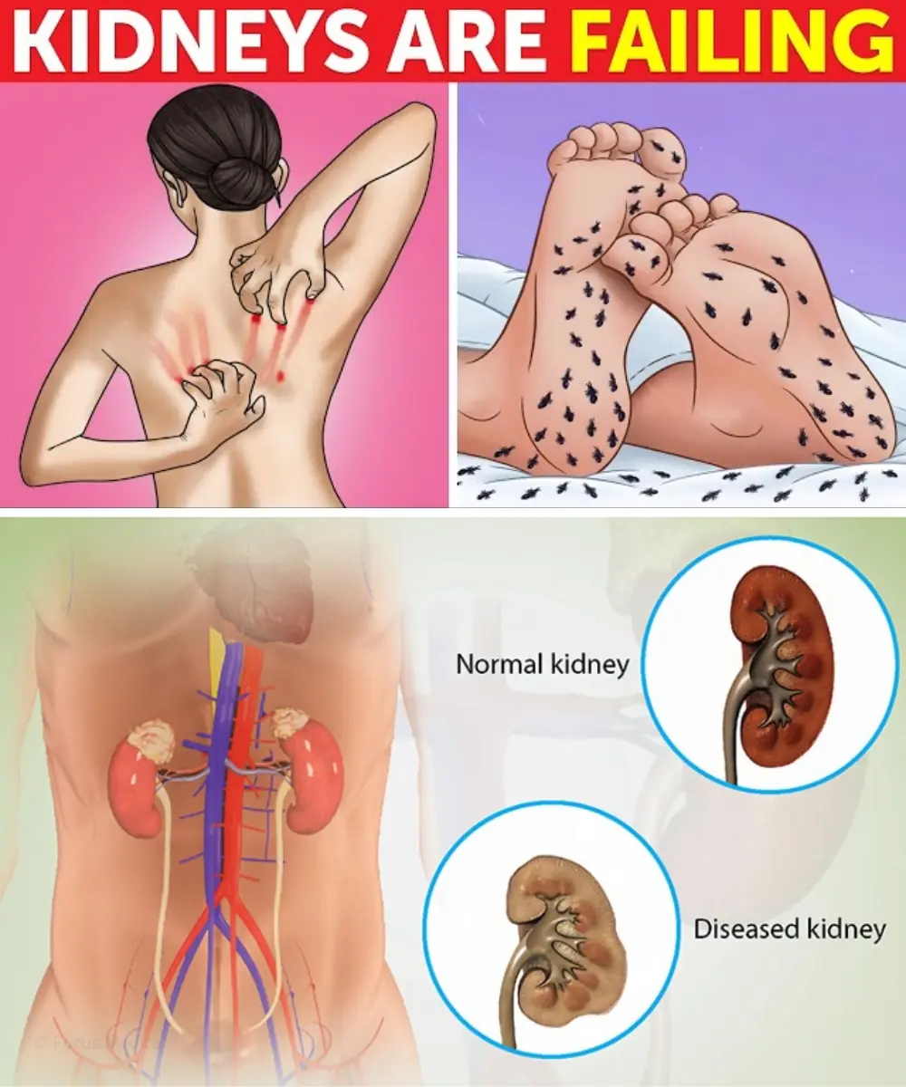 13 Alarming Signs of Chronic Kidney Disease (Are You at Risk?)