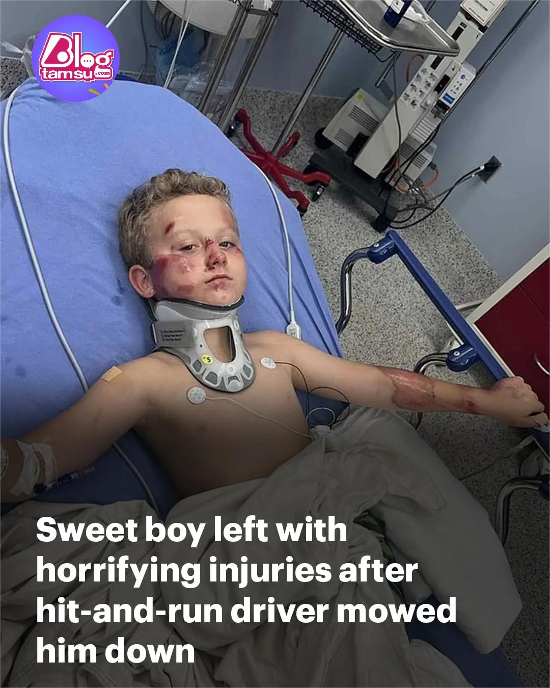 Sweet boy, 8, breaks silence after callous driver mowed him down: 'It hurts so much'