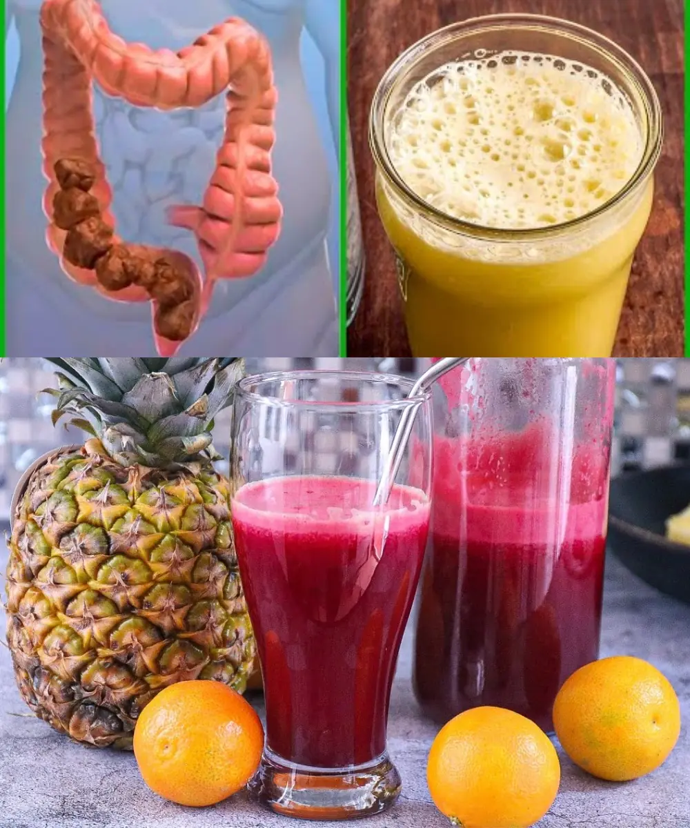 Drink This Smoothie Once a Day to Help Expel Parasites Naturally