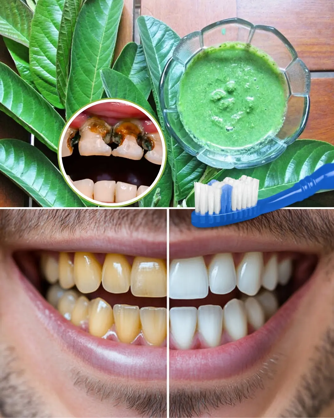 Grandma’s Shocking Secret to a Hollywood Smile: Guava Leaves Unveiled!