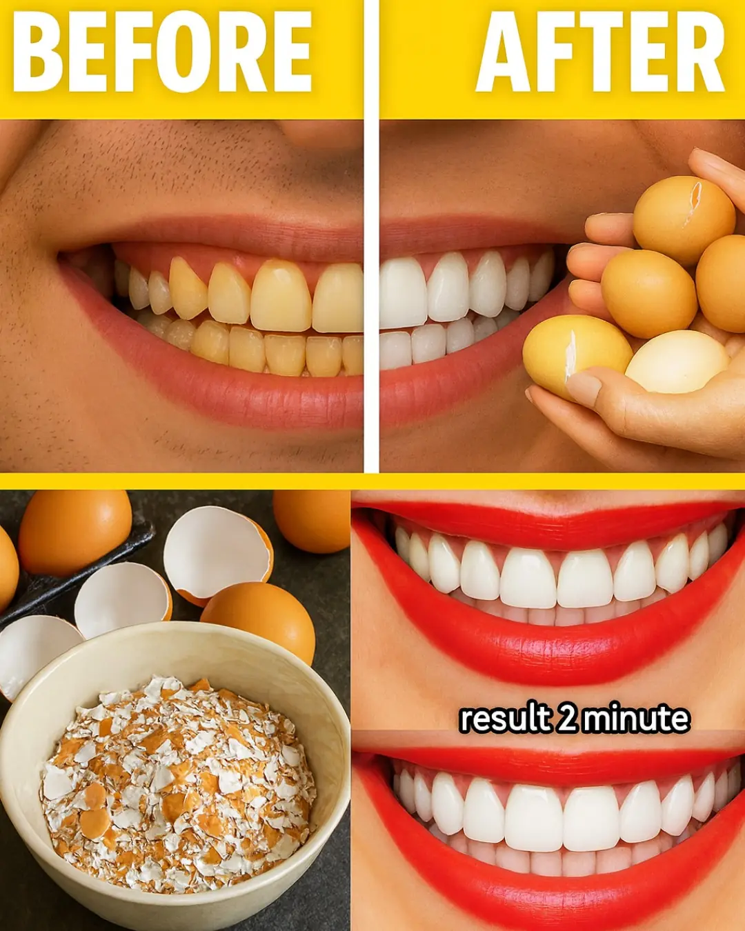 Can Kitchen Staples Unveil a Dazzling Smile in 5 Minutes?