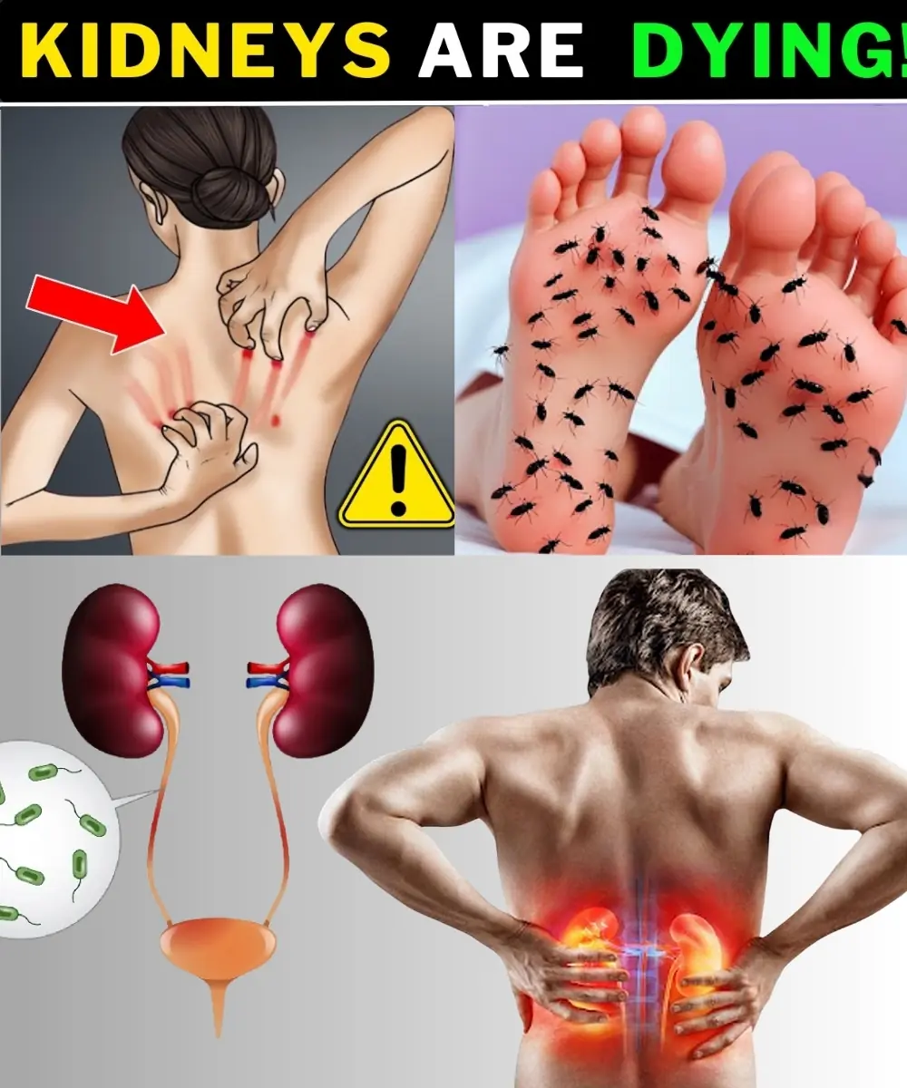 15 Deadly Kidney Signs You Must Catch Early