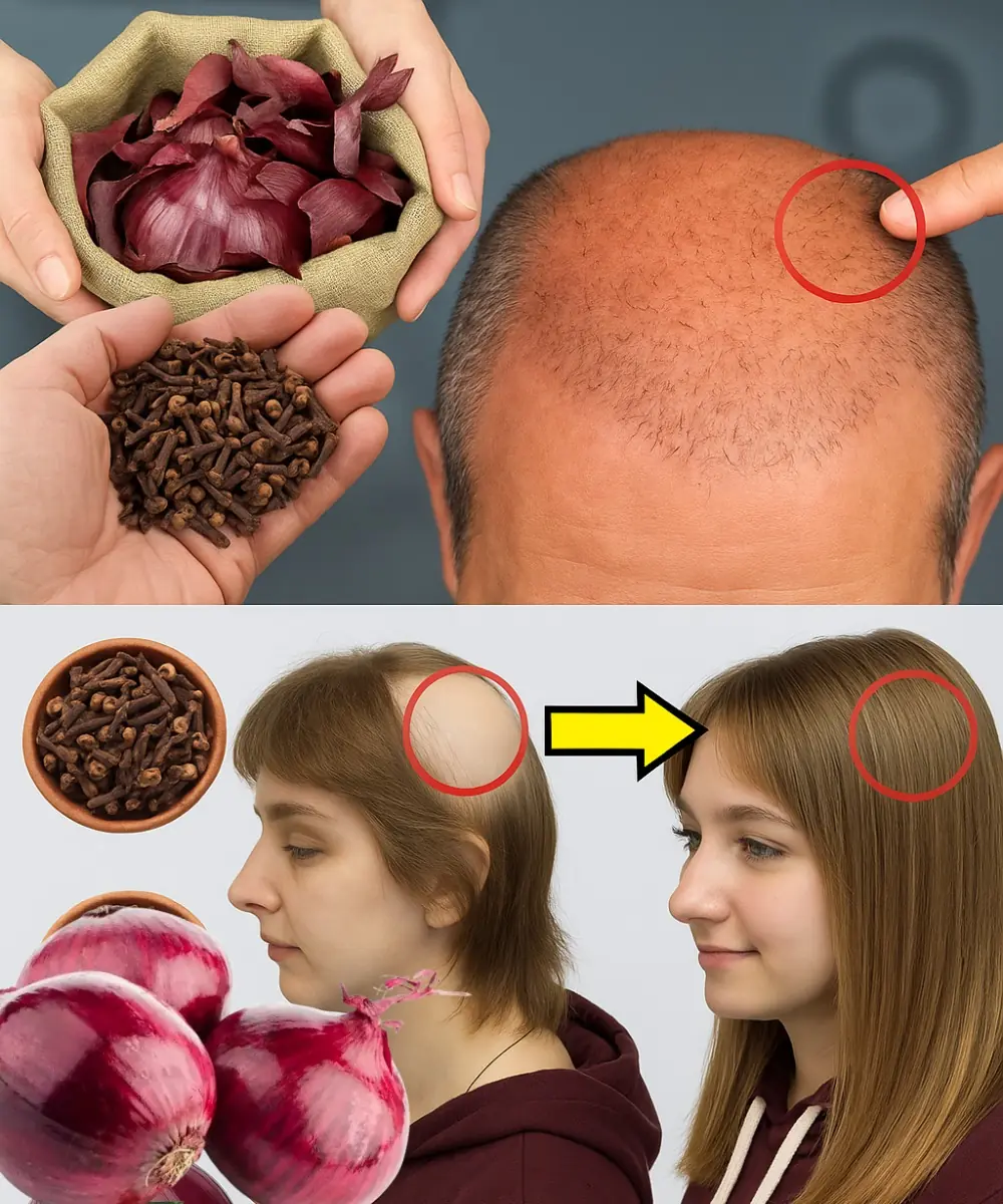 Discover the Hidden Power of Cloves and Onion Peels for Stunning Hair Growth