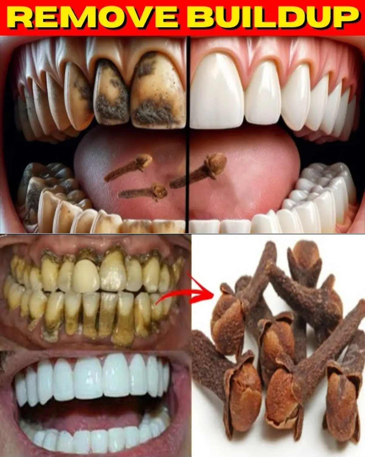 Discover Clove’s Hidden Power for a Healthier Smile