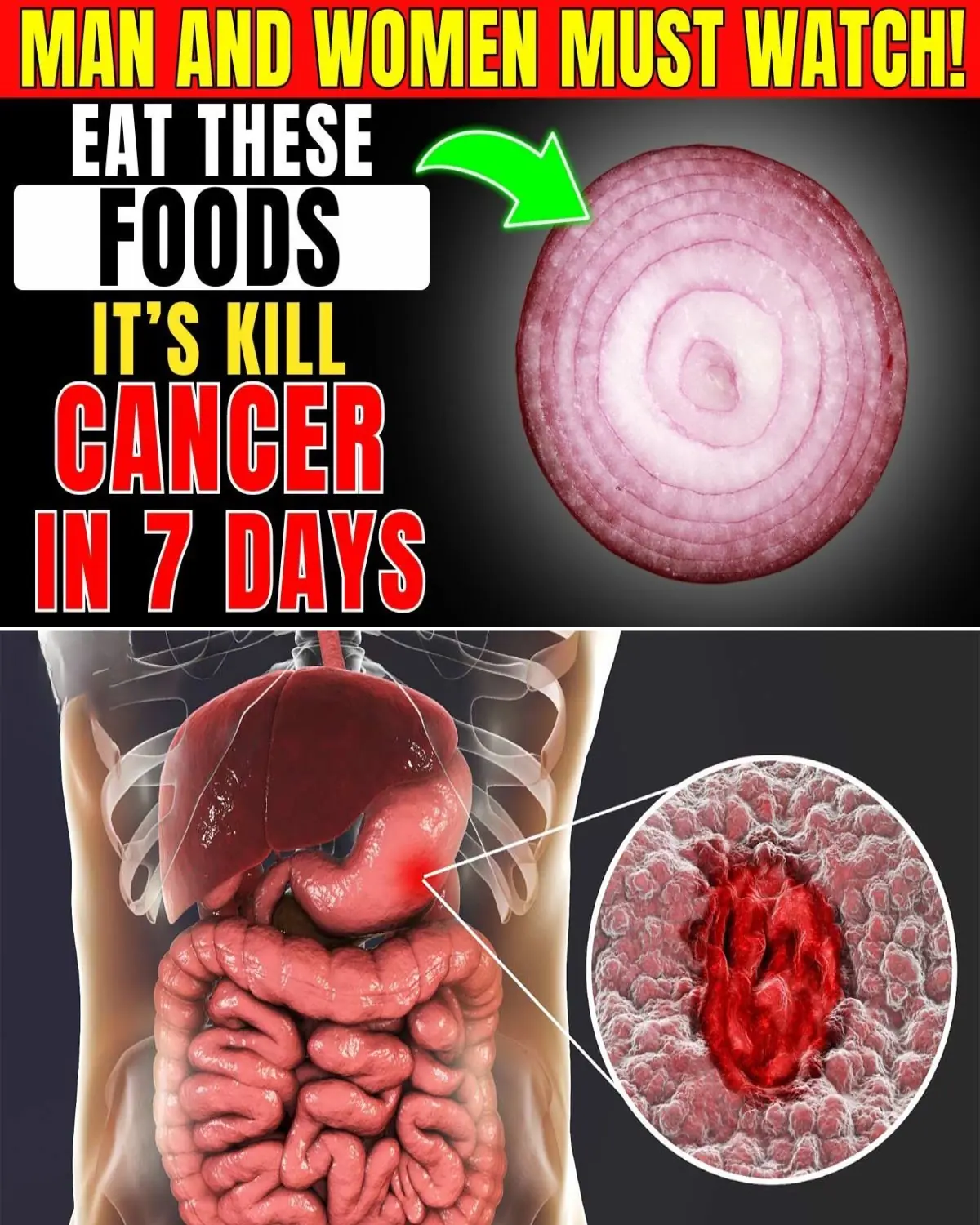10 Powerful Foods That Could Help Fight Cancer Naturally