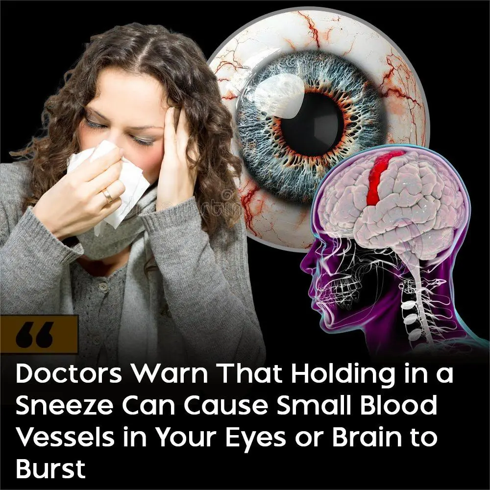 Doctors Warn: Stifling a Sneeze Can Cause Unexpected Injuries