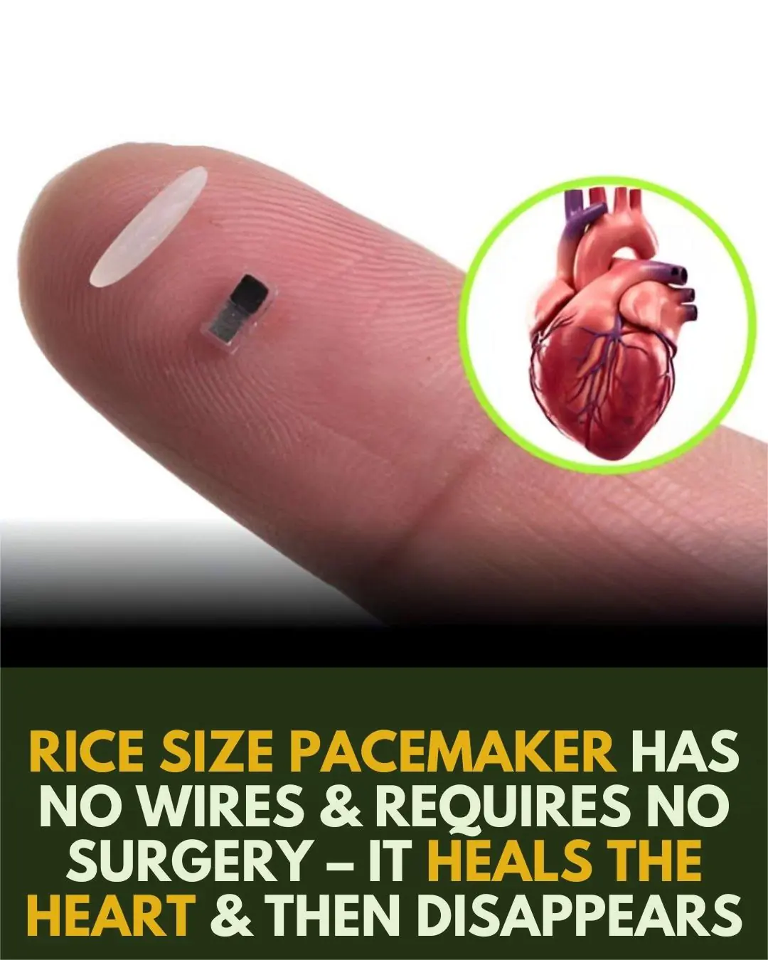 This Rice-Sized Pacemaker Heals the Heart, Then Disappears