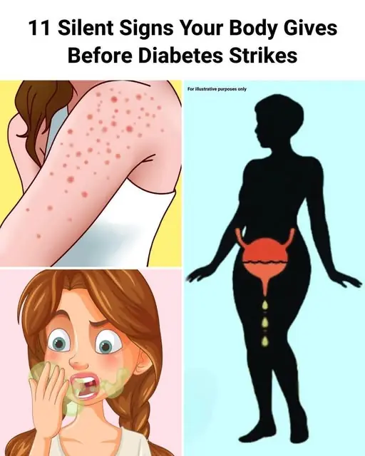 9 Warning Signs of Diabetes You Might Be Overlooking