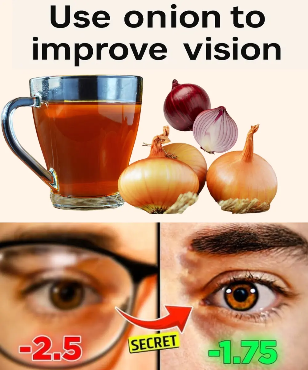 Use Onion to Improve Vision in 5 Days: How to Improve Your Eyesight Naturally at Home