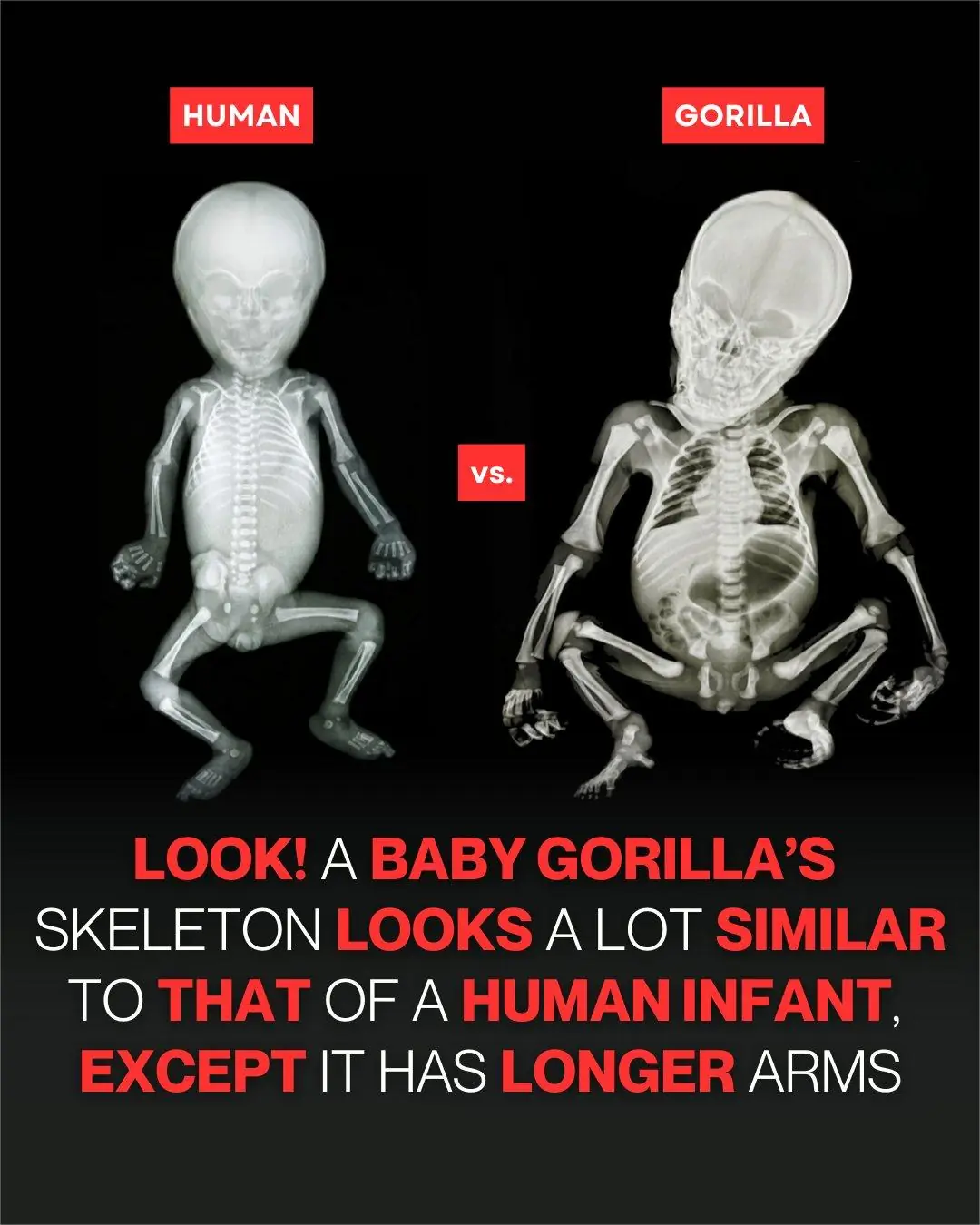 Baby Gorilla Skeletons Show Striking Similarities to Human Infants, Scientists Explain