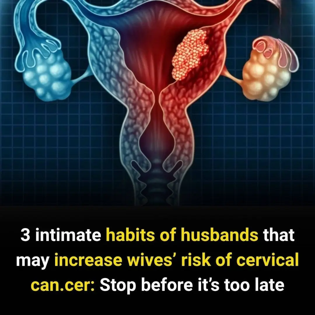 What Causes Cervical Cancer? A Guide to Risks, Prevention & HPV