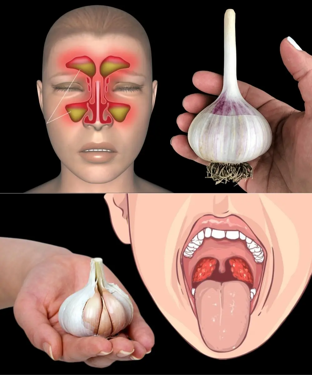Garlic Destroys Urinary System Infections! Just Do This…