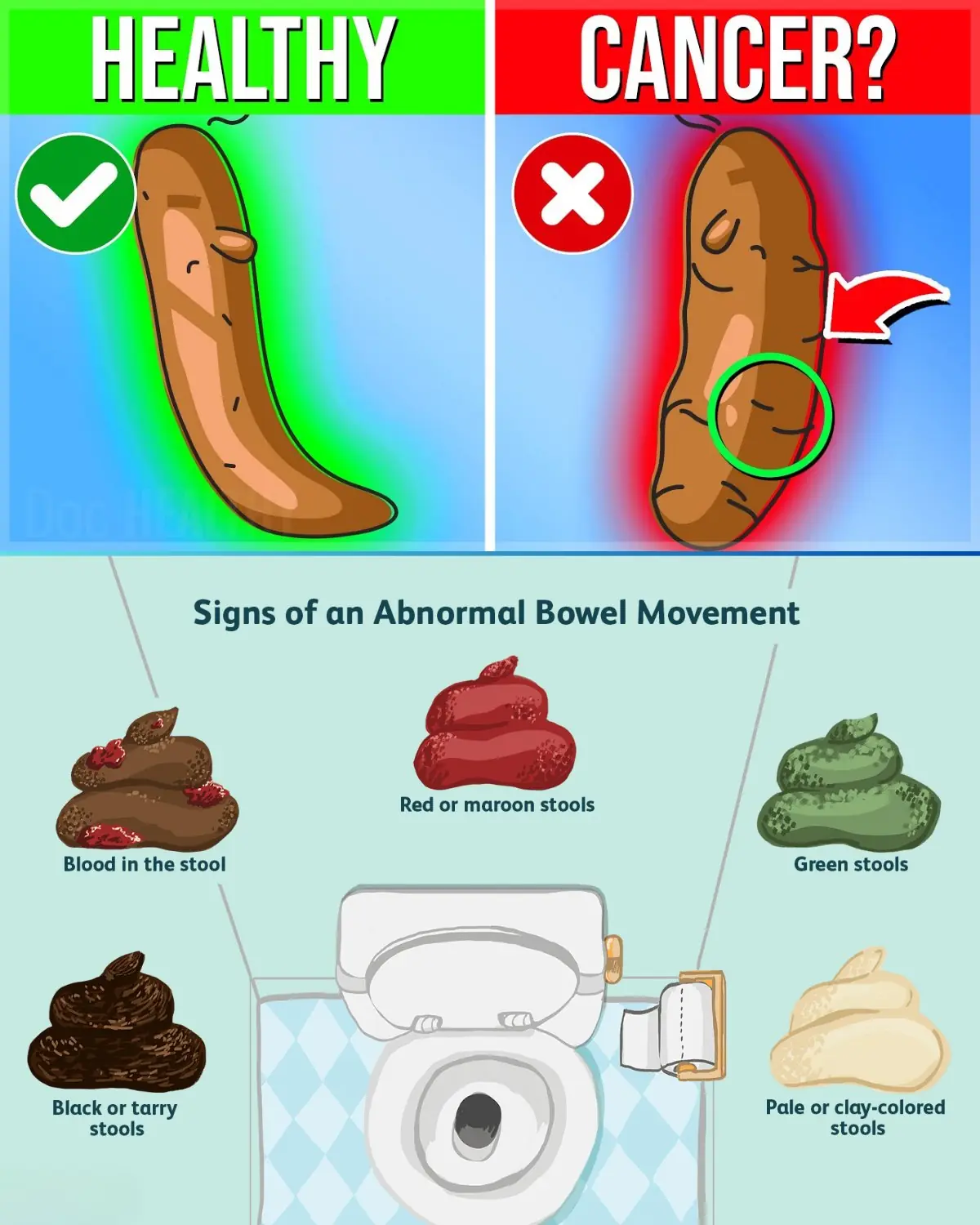 What Your Stool Color Reveals About Your Health