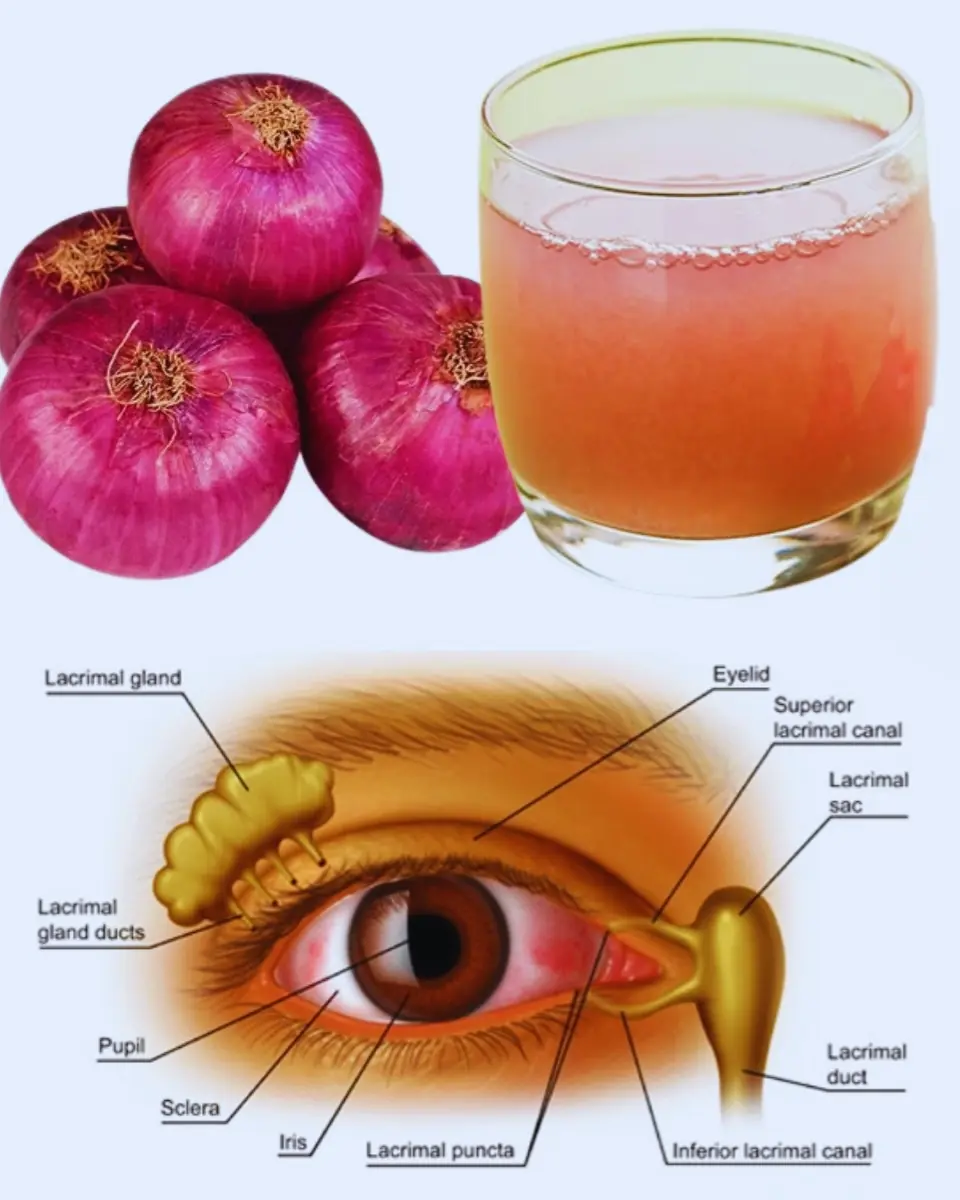 Onion Juice for Eye Health: A Gentle Tradition You Might Not Know About