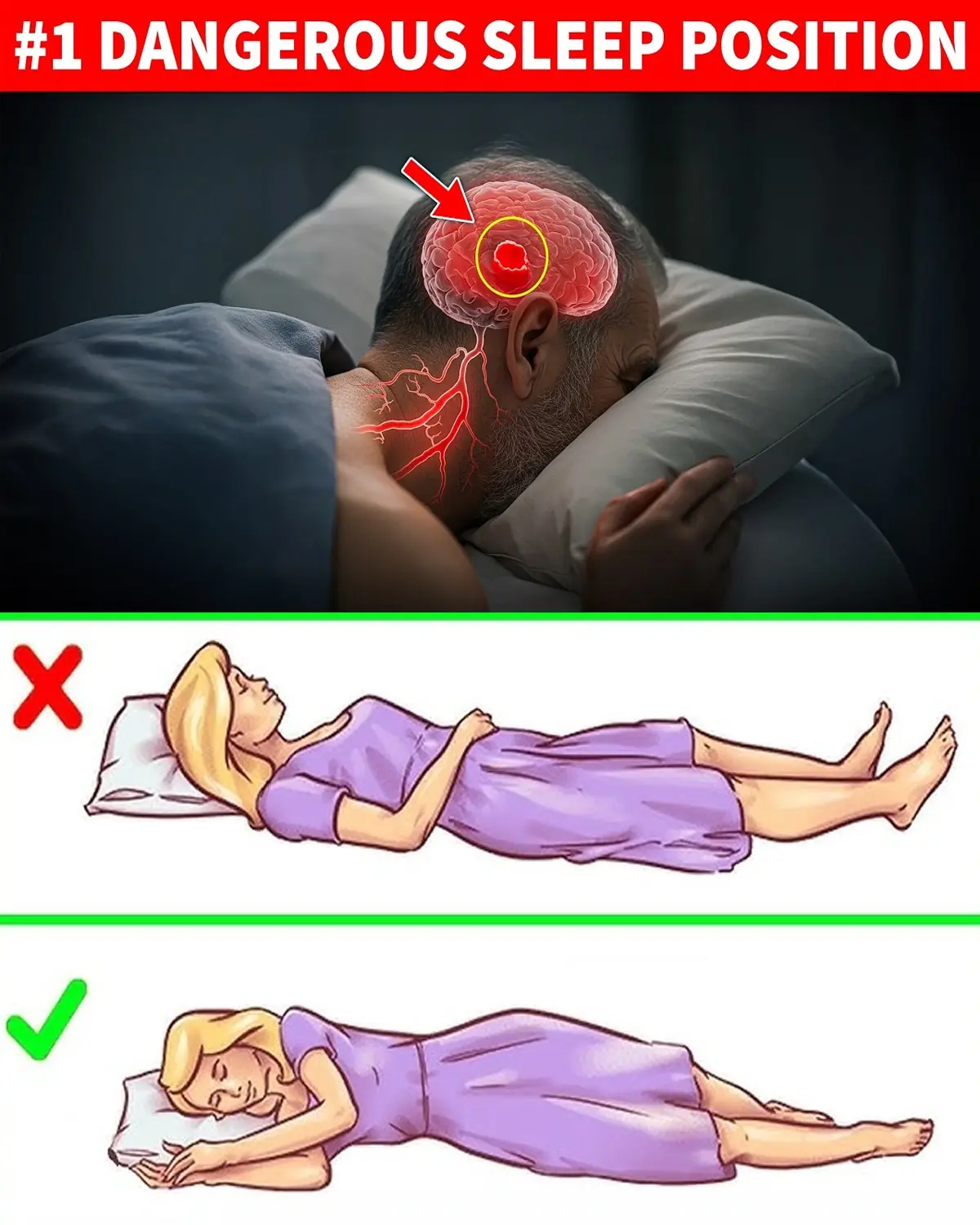 Could Your Sleeping Position Affect Your Stroke Risk?
