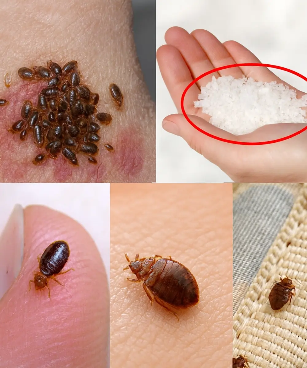Bedbugs Will Disappear from Your Garden in Minutes by Doing This (Natural & Safe Tip!) 🌱✨