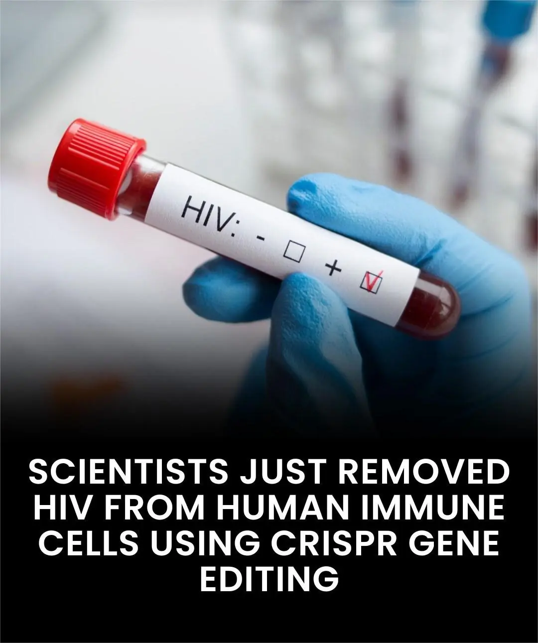 CRISPR Gene Editing Moves a Step Closer to an HIV Cure — But Scientists Urge Patience