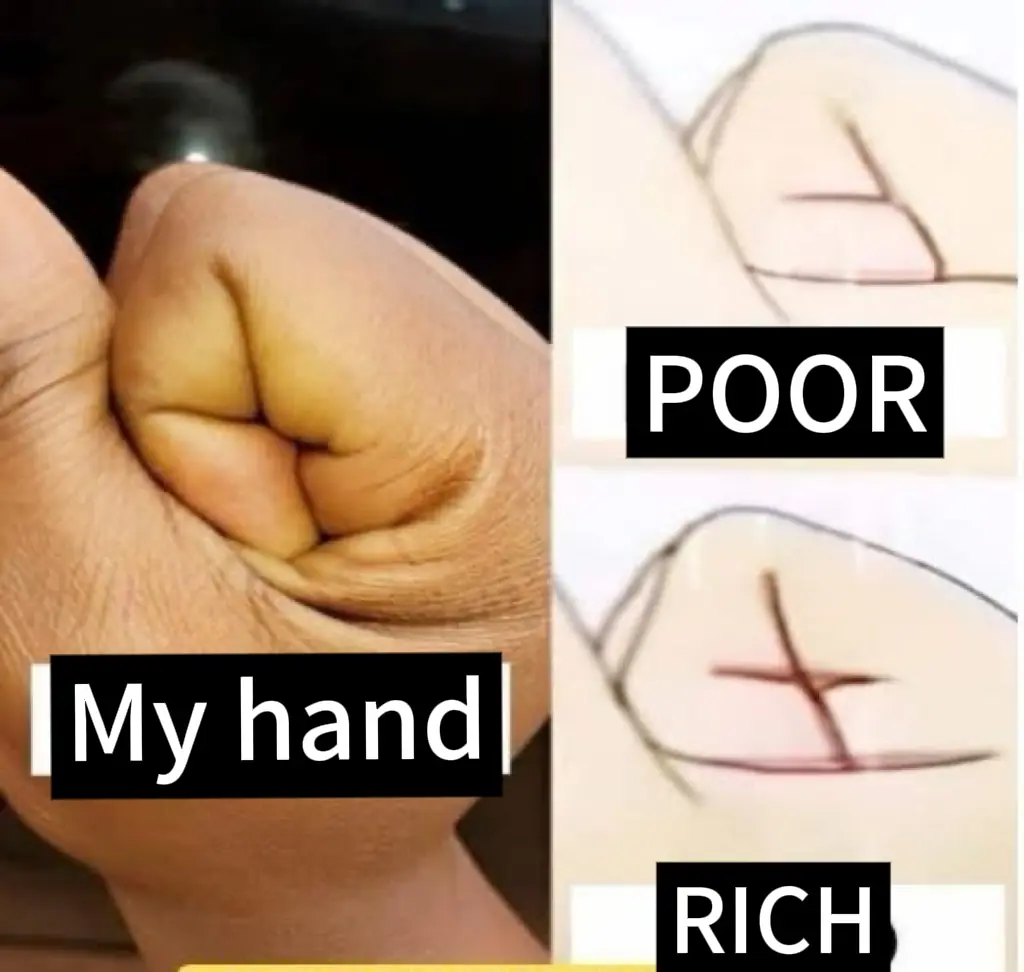 The Secret of Our Hands: Does It Reveal Wealth or Poverty?