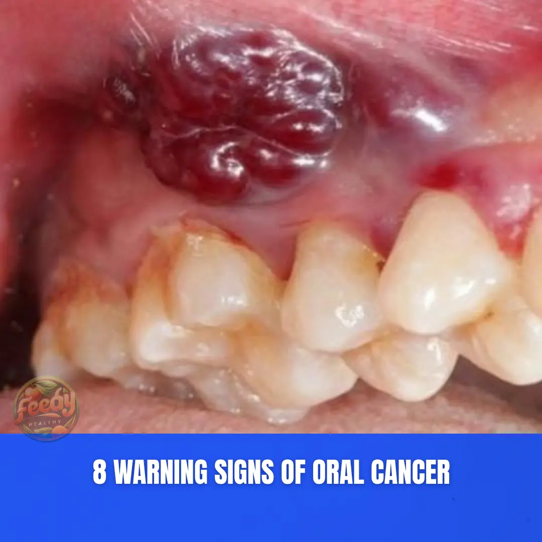 8 Warning Signs of Oral Cancer