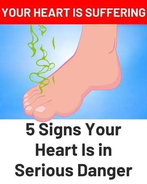 5 Warning Signs Your Heart May Be in Serious Danger