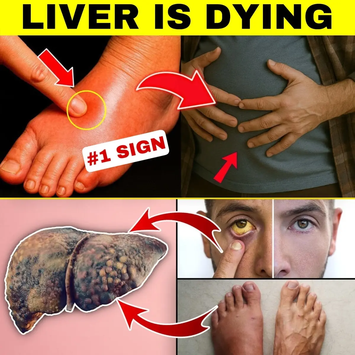 15 Early Warning Signs Your Liver Might Be in Trouble