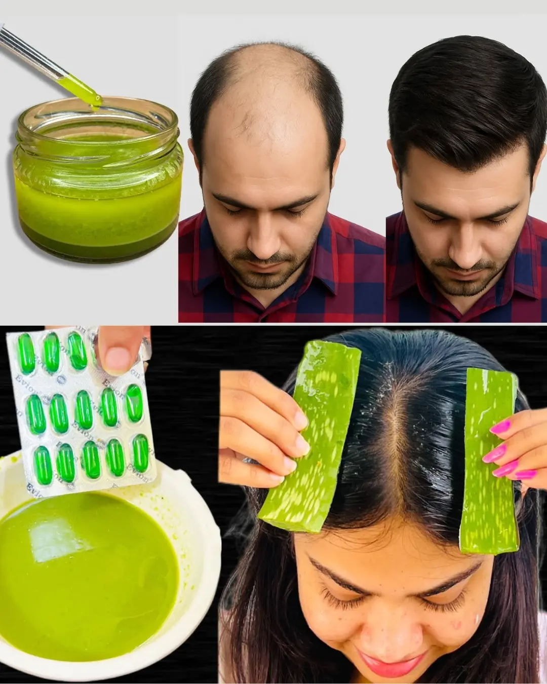 Apply Aloe Vera This Way Before Washing Hair in the Morning for Fast Hair Growth and Dandruff-Free Scalp