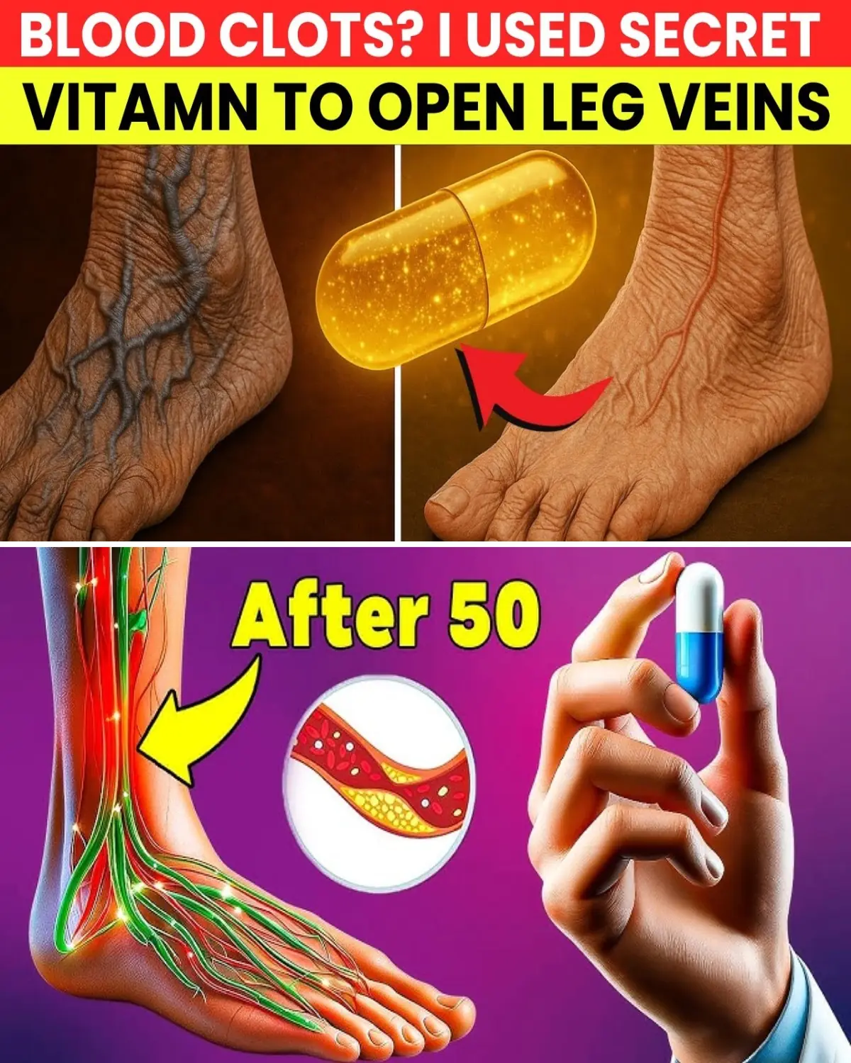 This Vitamin Could Help Reduce Blood Clot Risk in Your Legs – Seniors, Here’s What You Need to Know