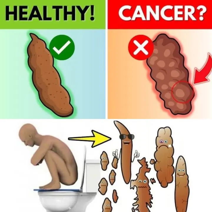 The Color of Your Stool Is Warning You About Your Health!