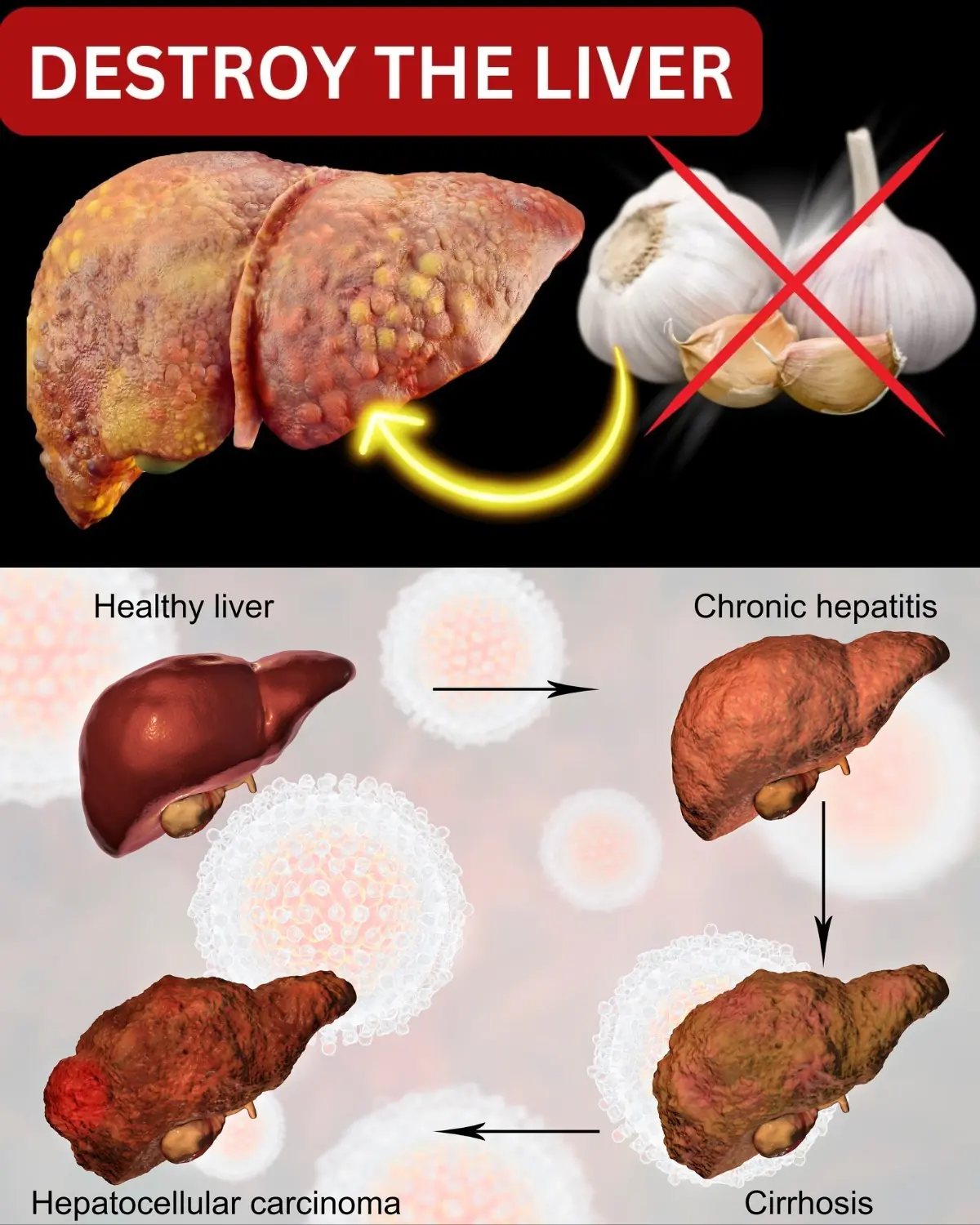 Top 5 Foods That Can DAMAGE Your Liver Forever!