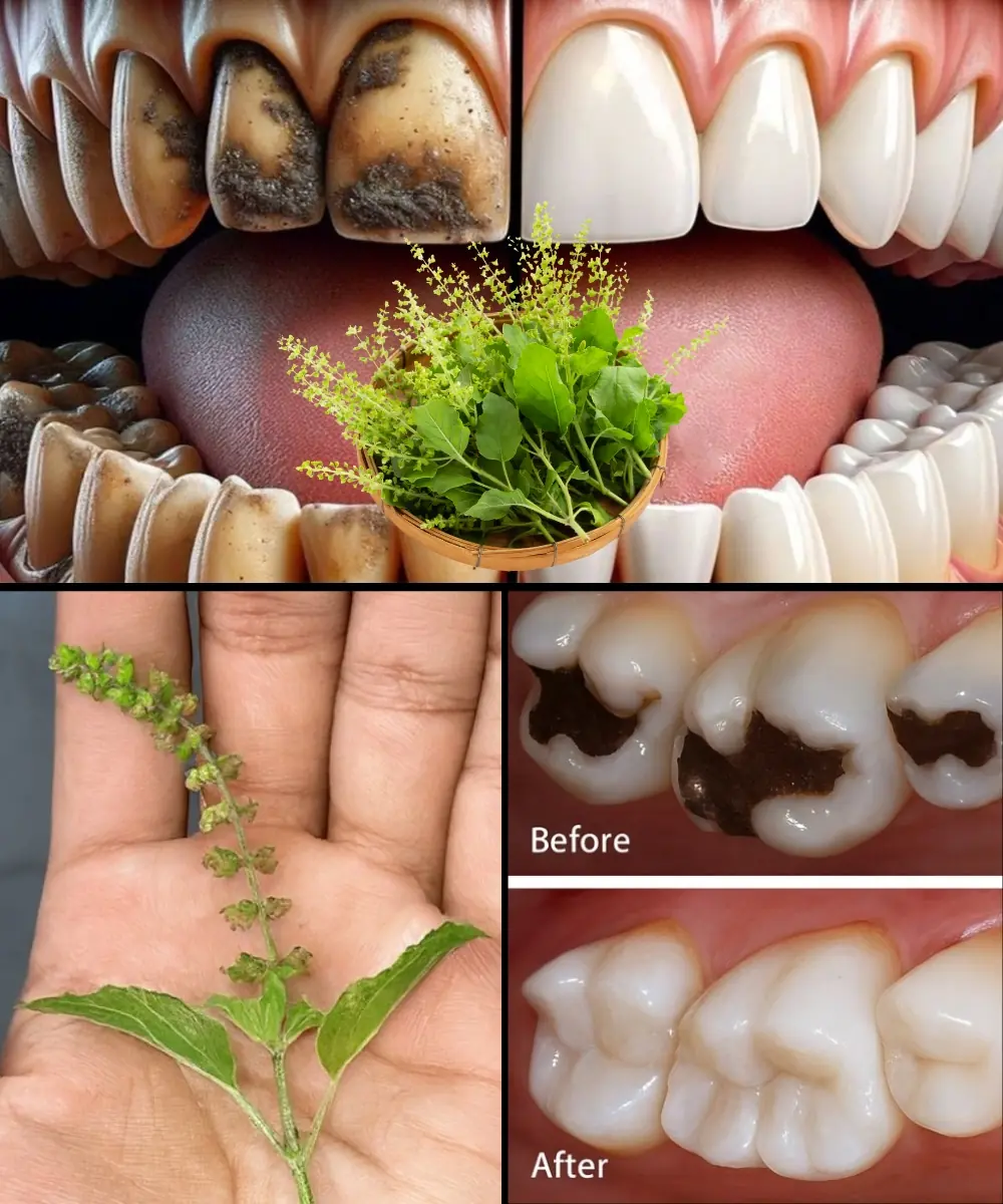 Unlock the Secret to a Radiant Smile: How Holy Basil (Tulsi) Transforms Your Oral Health! š¦·
