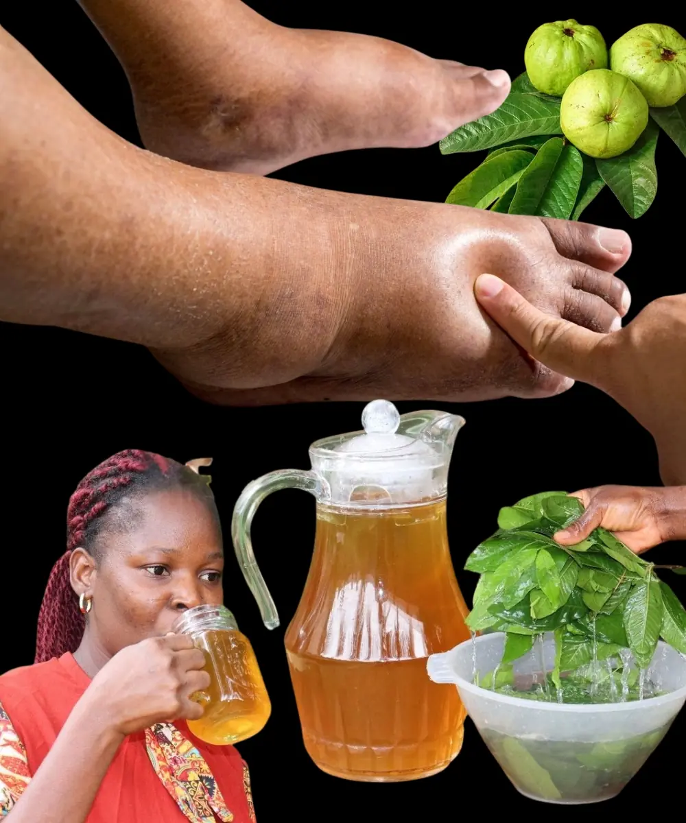 Say Goodbye to Swollen Legs, Ankles, and Feet with This Simple Herbal Tea