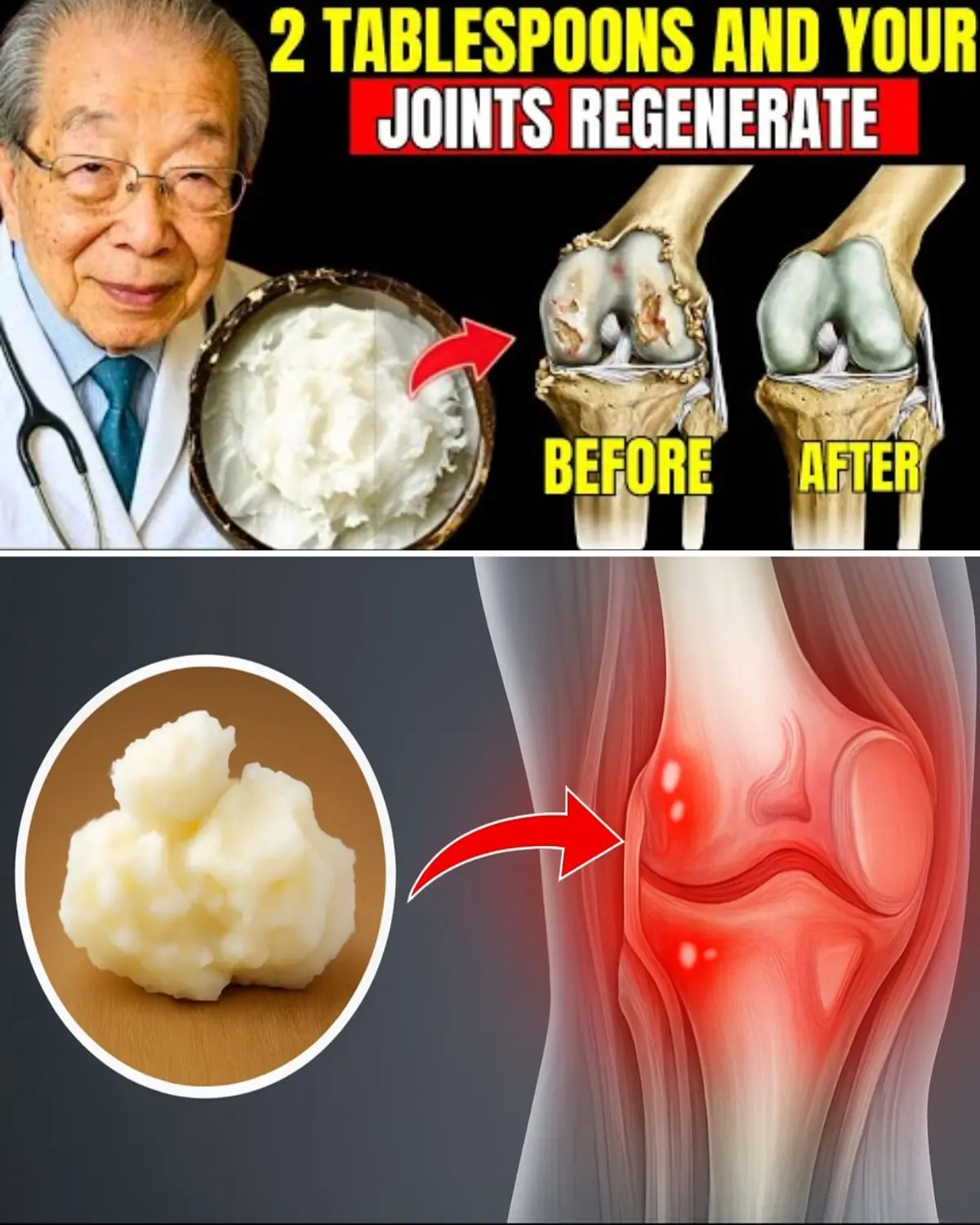 Seniors, Sip This to Revive Your Knee Cartilage Fast