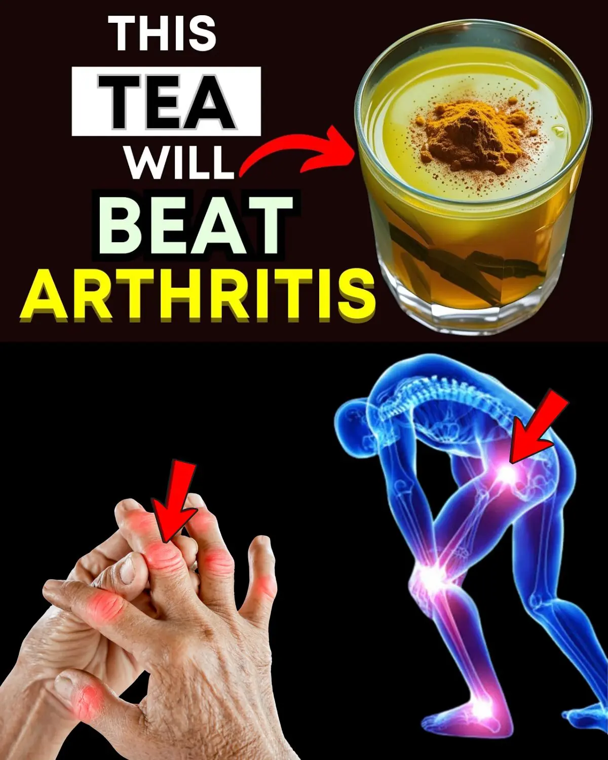 Top 3 Best Teas for Arthritis Pain Relief & Inflammation