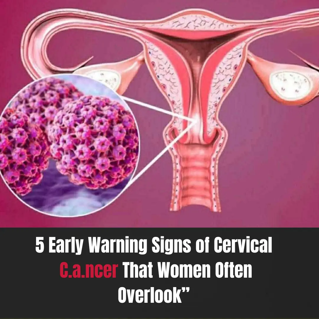 5 early warning signs of cervical cancer